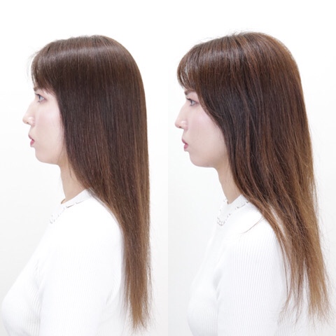 before＆after